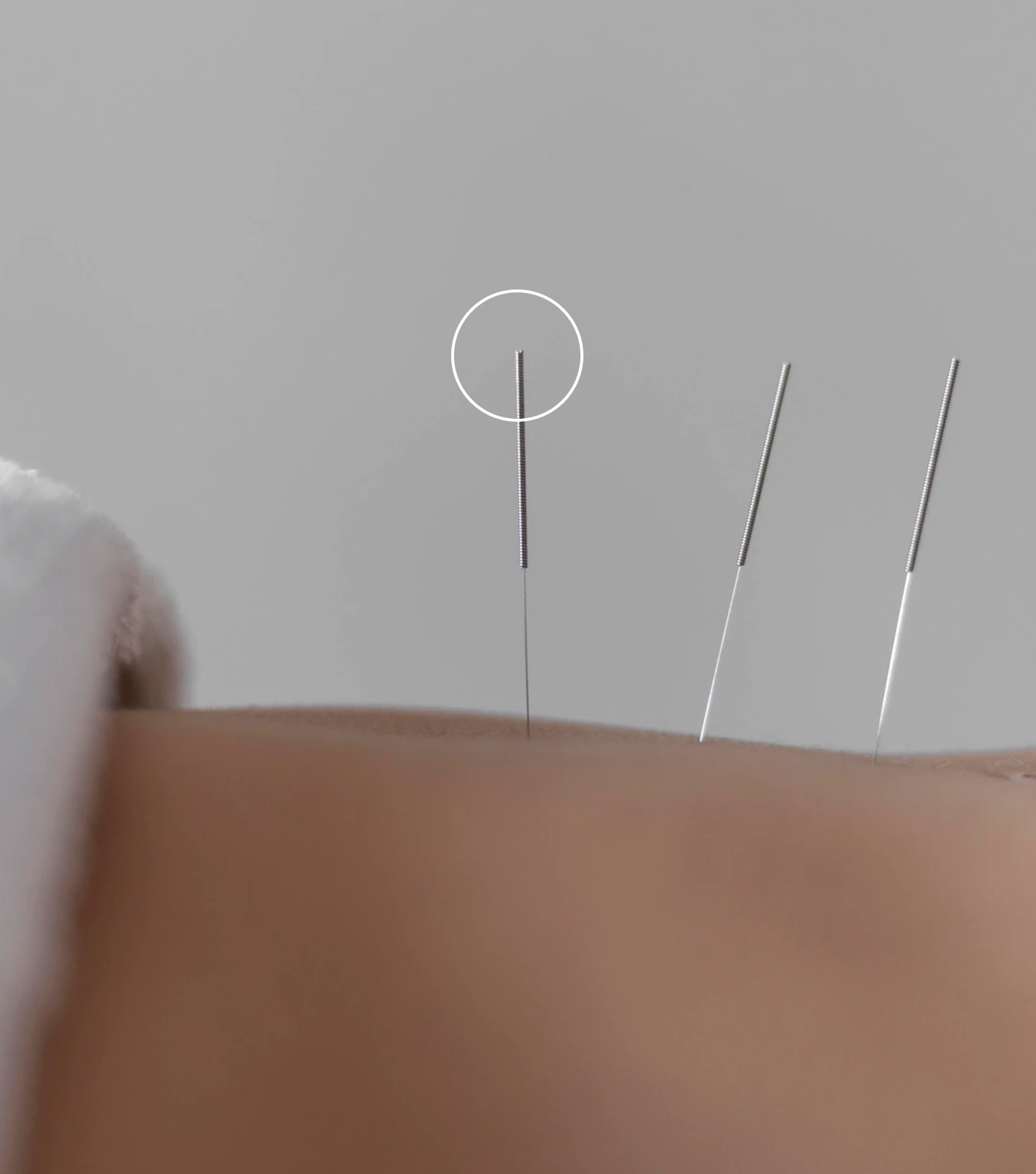 Bendigo Acupuncture and Chinese Herbal Medicine Clinic Bendigo